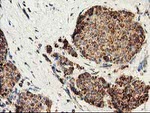 CLPP Antibody in Immunohistochemistry (Paraffin) (IHC (P))