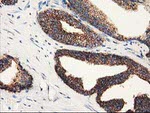 CLPP Antibody in Immunohistochemistry (Paraffin) (IHC (P))