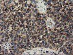 CLPP Antibody in Immunohistochemistry (Paraffin) (IHC (P))