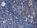 CLPP Antibody in Immunohistochemistry (Paraffin) (IHC (P))