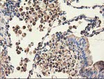 CLPP Antibody in Immunohistochemistry (Paraffin) (IHC (P))