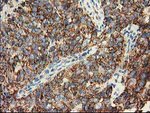 CLPP Antibody in Immunohistochemistry (Paraffin) (IHC (P))
