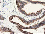 CLPP Antibody in Immunohistochemistry (Paraffin) (IHC (P))