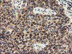 CLPP Antibody in Immunohistochemistry (Paraffin) (IHC (P))