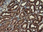 CLPP Antibody in Immunohistochemistry (Paraffin) (IHC (P))