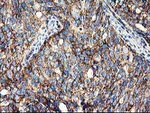 CLPP Antibody in Immunohistochemistry (Paraffin) (IHC (P))