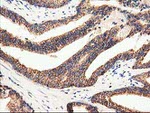 CLPP Antibody in Immunohistochemistry (Paraffin) (IHC (P))
