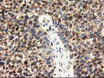 CLPP Antibody in Immunohistochemistry (Paraffin) (IHC (P))