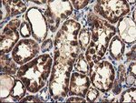 CLPP Antibody in Immunohistochemistry (Paraffin) (IHC (P))