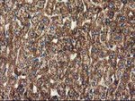CLPP Antibody in Immunohistochemistry (Paraffin) (IHC (P))
