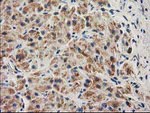 CLPP Antibody in Immunohistochemistry (Paraffin) (IHC (P))