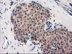 CLPP Antibody in Immunohistochemistry (Paraffin) (IHC (P))
