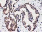 CLPP Antibody in Immunohistochemistry (Paraffin) (IHC (P))