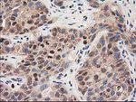 CLPP Antibody in Immunohistochemistry (Paraffin) (IHC (P))