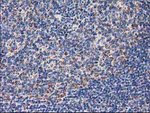 CLPP Antibody in Immunohistochemistry (Paraffin) (IHC (P))