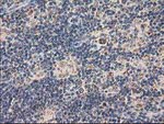 CLPP Antibody in Immunohistochemistry (Paraffin) (IHC (P))