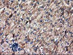 CLPP Antibody in Immunohistochemistry (Paraffin) (IHC (P))