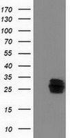 CLPP Antibody in Western Blot (WB)