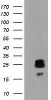 CLPP Antibody in Western Blot (WB)