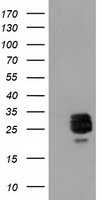 CLPP Antibody in Western Blot (WB)