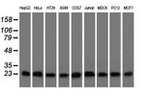 CLPP Antibody in Western Blot (WB)