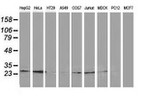 CLPP Antibody in Western Blot (WB)
