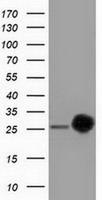 CLPP Antibody in Western Blot (WB)