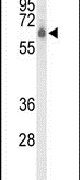 CLPTM1L Antibody in Western Blot (WB)