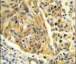 Clathrin Light Chain A Antibody in Immunohistochemistry (IHC)