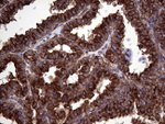 CLTA Antibody in Immunohistochemistry (Paraffin) (IHC (P))