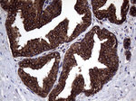 CLTA Antibody in Immunohistochemistry (Paraffin) (IHC (P))