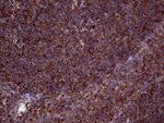 CLTA Antibody in Immunohistochemistry (Paraffin) (IHC (P))