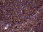 CLTA Antibody in Immunohistochemistry (Paraffin) (IHC (P))