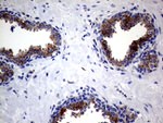 CLTA Antibody in Immunohistochemistry (Paraffin) (IHC (P))