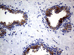 CLTA Antibody in Immunohistochemistry (Paraffin) (IHC (P))