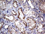 CLTA Antibody in Immunohistochemistry (Paraffin) (IHC (P))