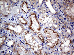 CLTA Antibody in Immunohistochemistry (Paraffin) (IHC (P))