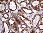 CLTA Antibody in Immunohistochemistry (Paraffin) (IHC (P))