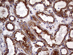 CLTA Antibody in Immunohistochemistry (Paraffin) (IHC (P))