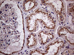 CLTA Antibody in Immunohistochemistry (Paraffin) (IHC (P))