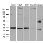 CLTA Antibody in Western Blot (WB)