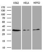 CLTA Antibody in Western Blot (WB)
