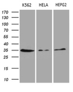 CLTA Antibody in Western Blot (WB)