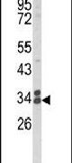 Clathrin Light Chain A Antibody in Western Blot (WB)