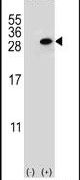 Clathrin Light Chain A Antibody in Western Blot (WB)