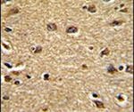 CLUAP1 Antibody in Immunohistochemistry (IHC)
