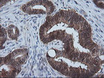 CMPK1 Antibody in Immunohistochemistry (Paraffin) (IHC (P))