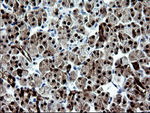 CMPK1 Antibody in Immunohistochemistry (Paraffin) (IHC (P))