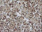 CMPK1 Antibody in Immunohistochemistry (Paraffin) (IHC (P))