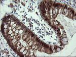 CMPK1 Antibody in Immunohistochemistry (Paraffin) (IHC (P))